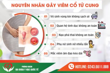 Tổng hợp viêm phụ khoa và cách điều trị